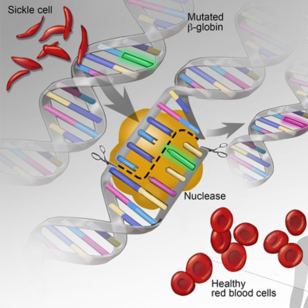 Sickle Cell Model A sickle cell timeline